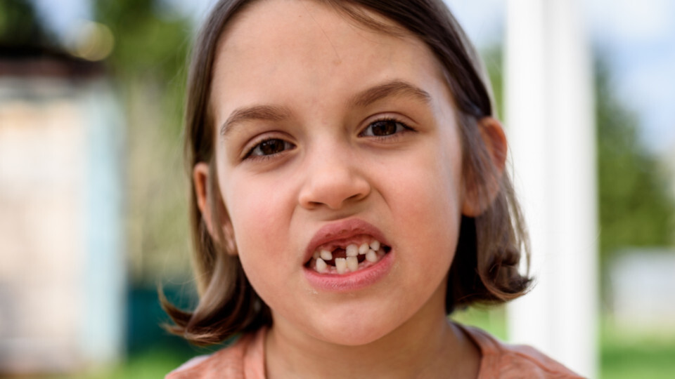 Bei Zahnunfall besser sofort zum Zahnarzt